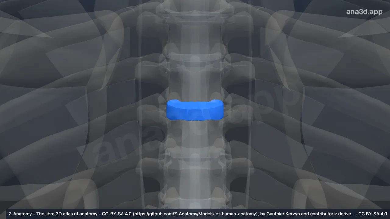 Model 3D: Diskus intervertebralis T5-T6