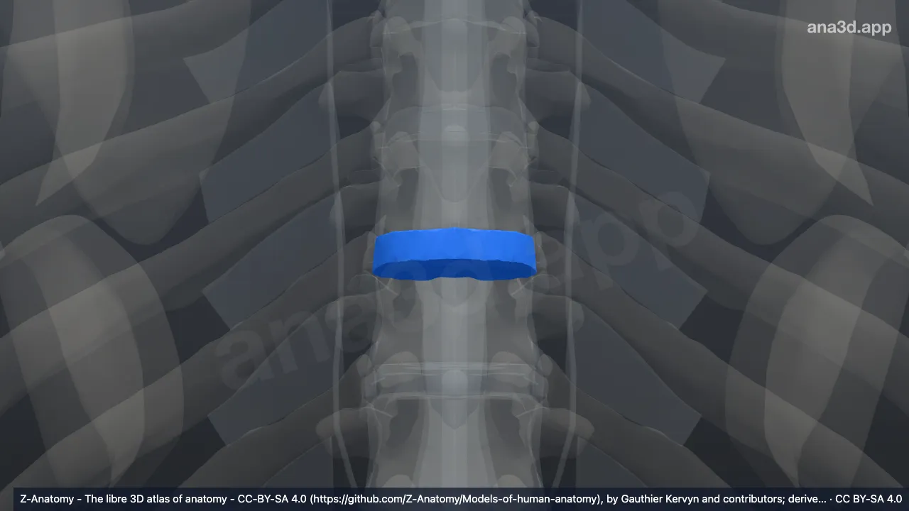 Model 3D: Diskus intervertebralis T8-T9
