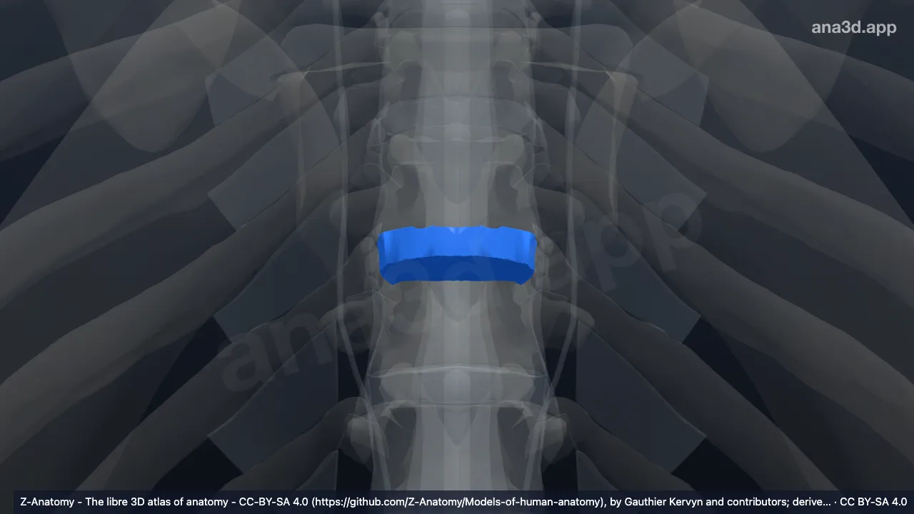 Model 3D: Diskus intervertebralis T9-T10