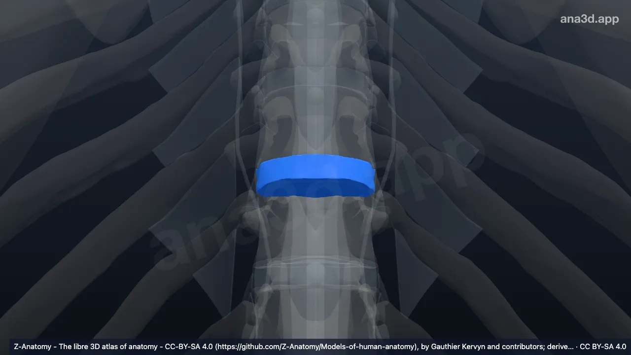 Model 3D: Diskus intervertebralis T10-T11