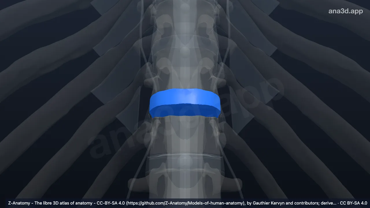 Model 3D: Diskus intervertebralis T11-T12