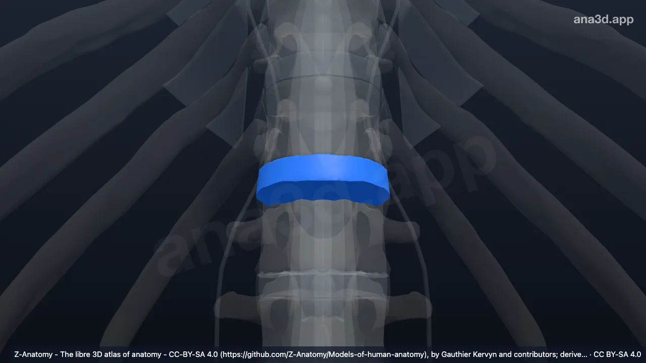 Model 3D: Diskus intervertebralis T12-L1
