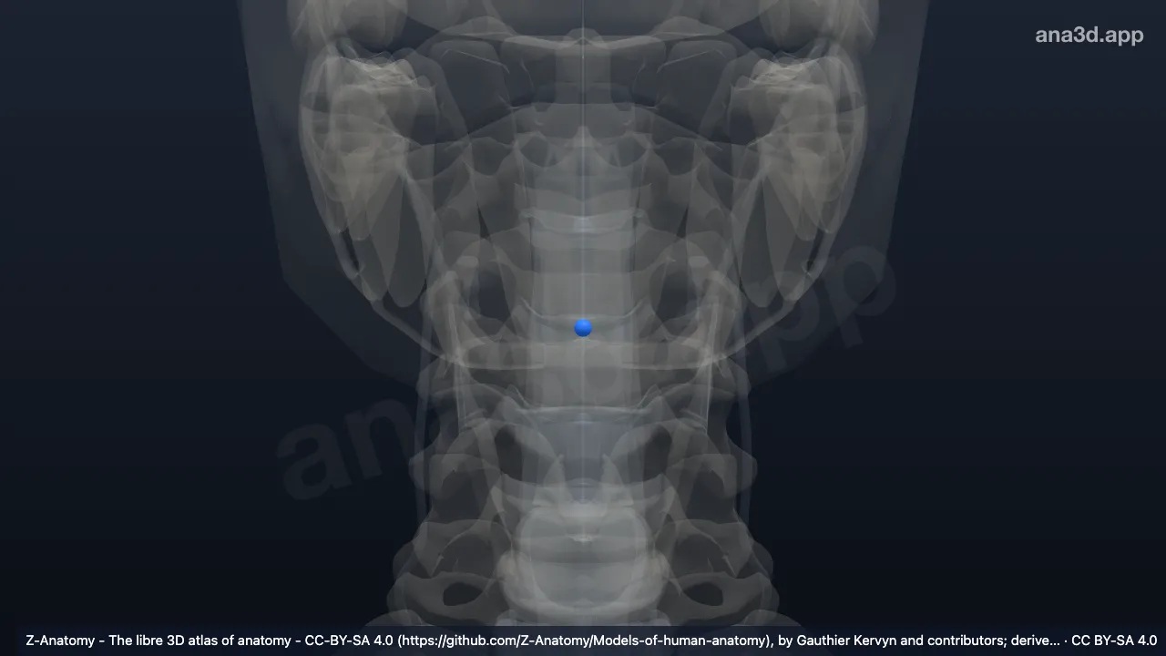 Modelo 3D: Núcleo pulposo C3-C4