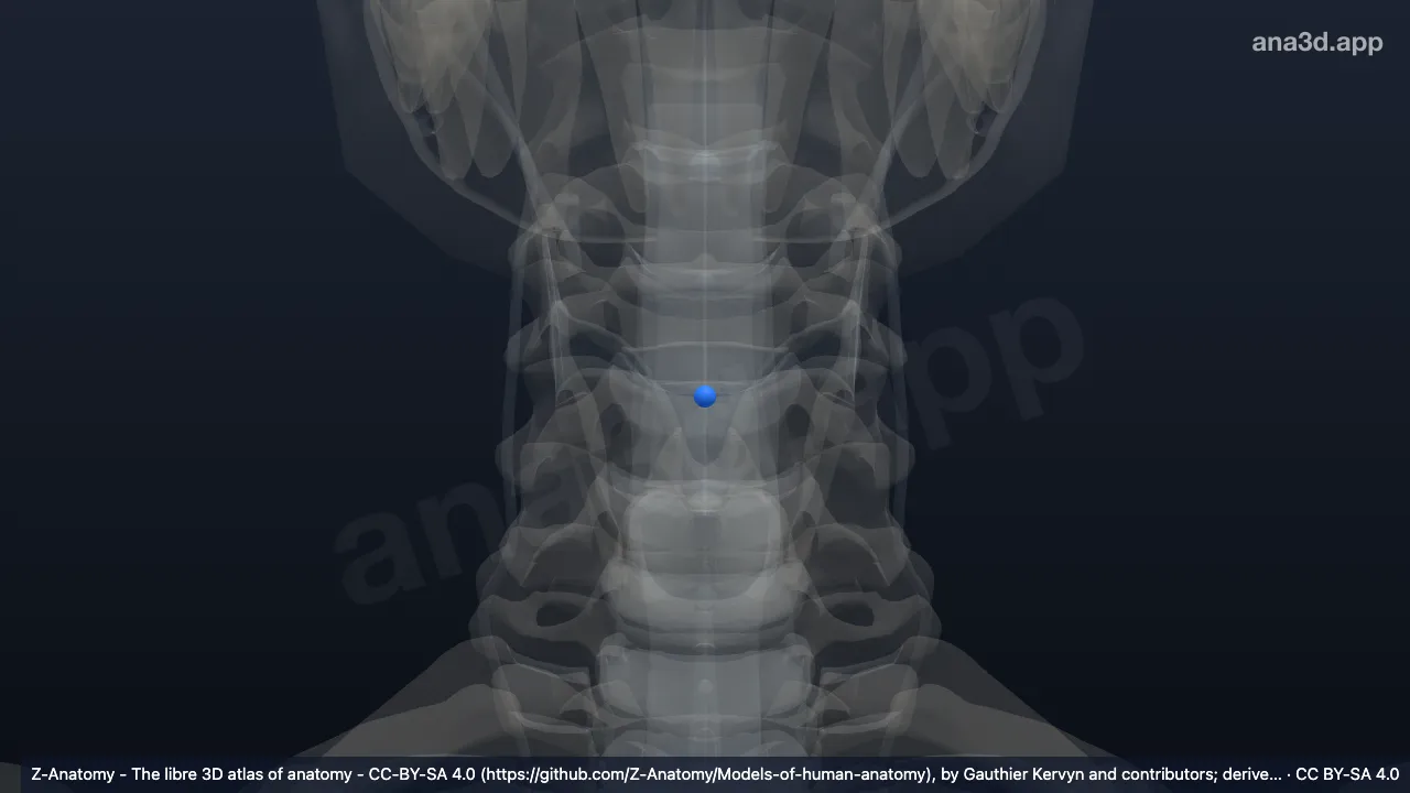 Model 3D: Nukleus pulposus C4-C5