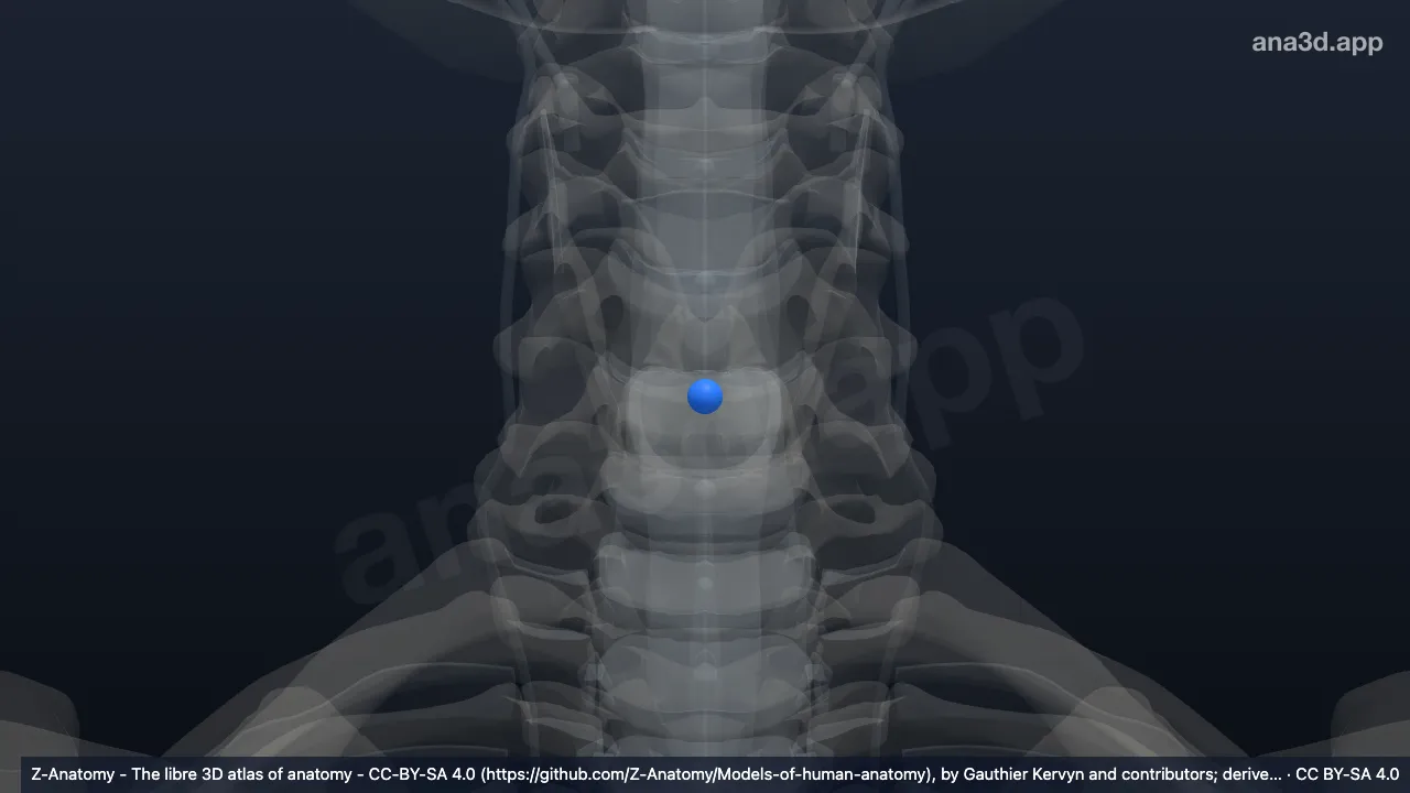 Model 3D: Nukleus pulposus C5-C6