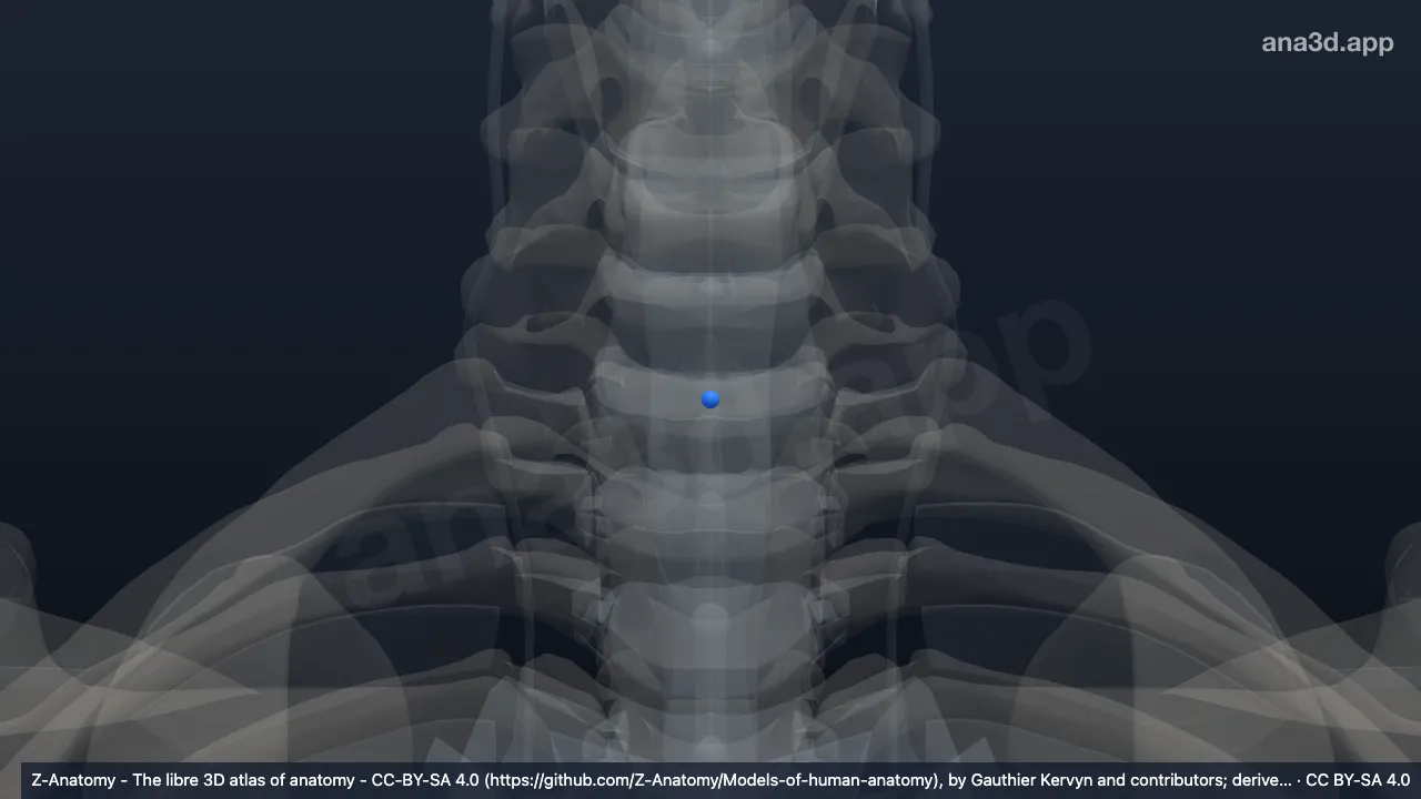 3D model: nucleus pulposus C7-T1