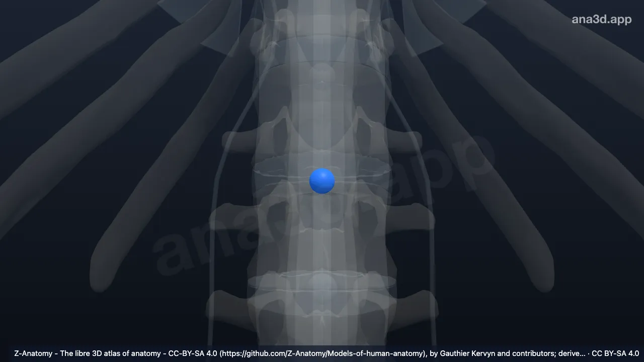 Modelo 3D: Núcleo pulposo L1-L2