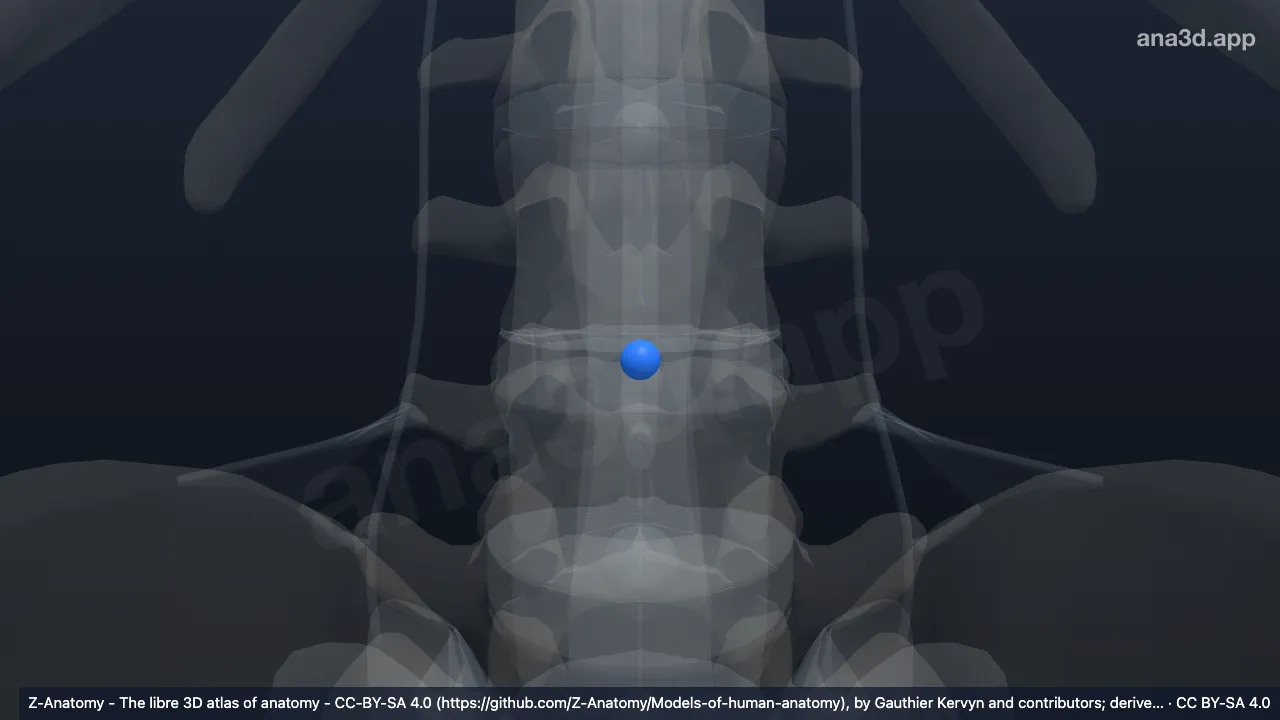 3D model: nucleus pulposus L3-L4