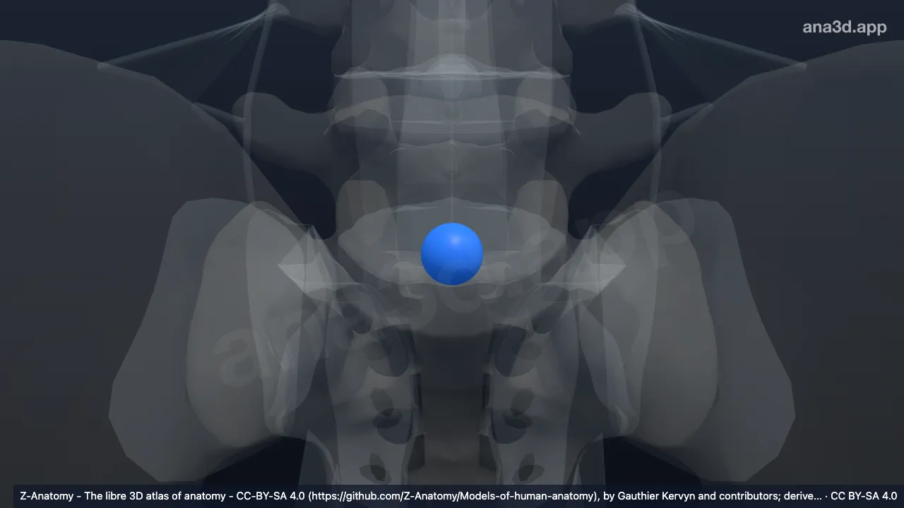 3D model: nucleus pulposus L5-S1