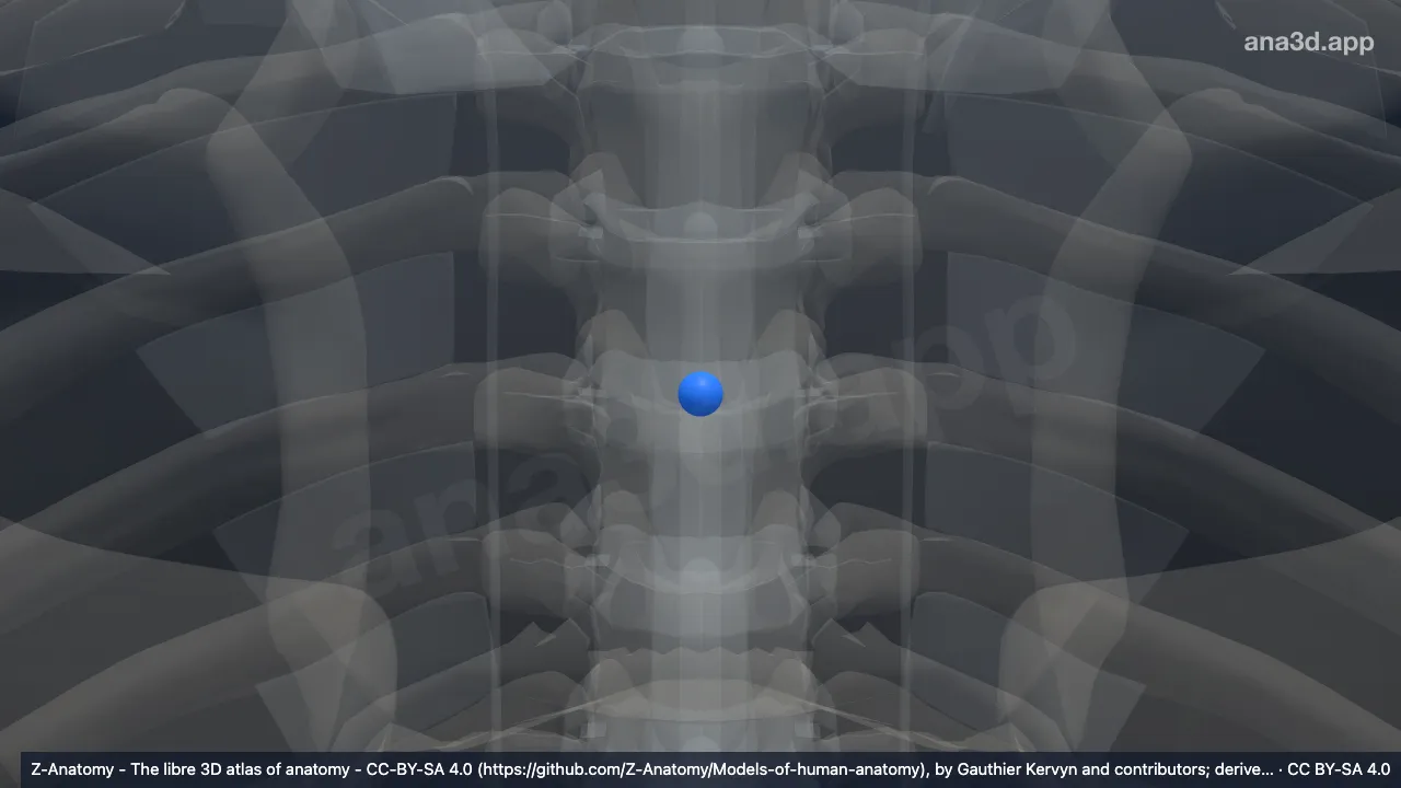 Modelo 3D: Núcleo pulposo T4-T5
