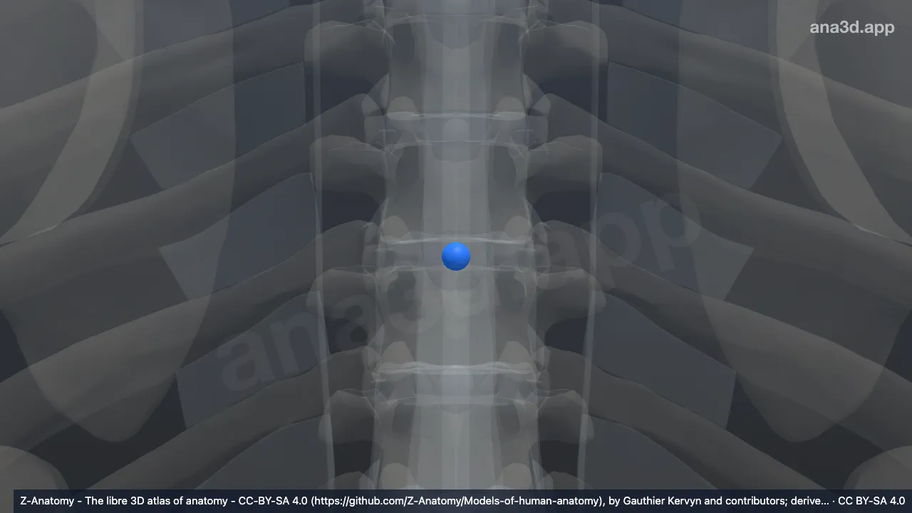Modelo 3D: Núcleo pulposo T6-T7