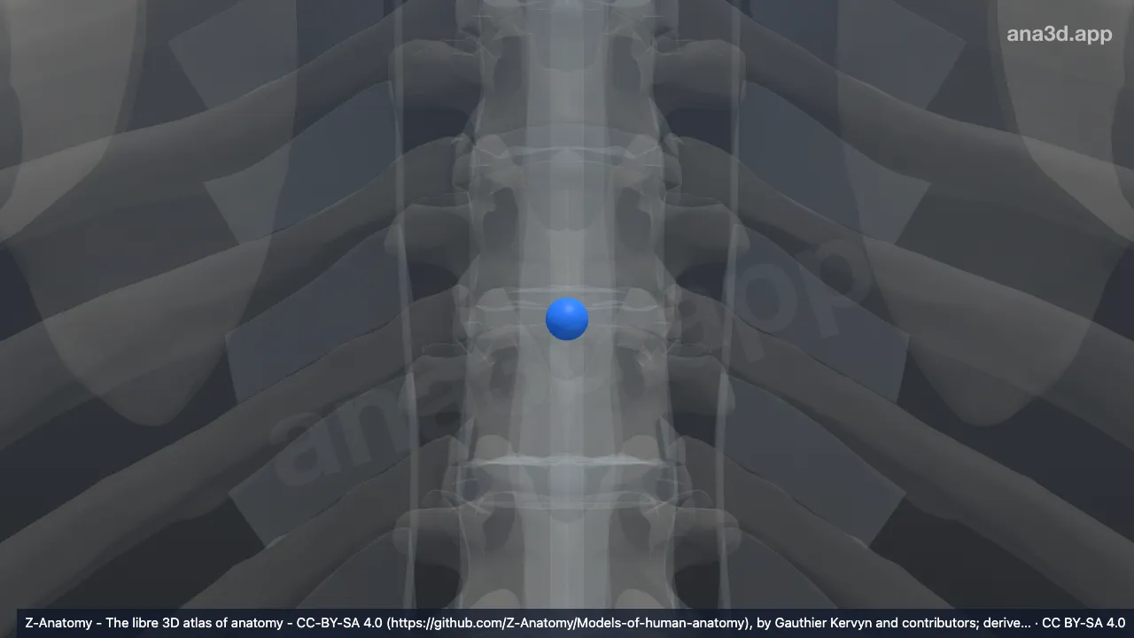 Modelo 3D: Núcleo pulposo T7-T8