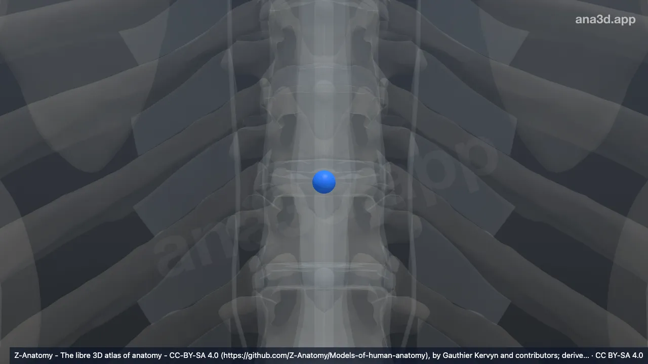 Modelo 3D: Núcleo pulposo T8-T9