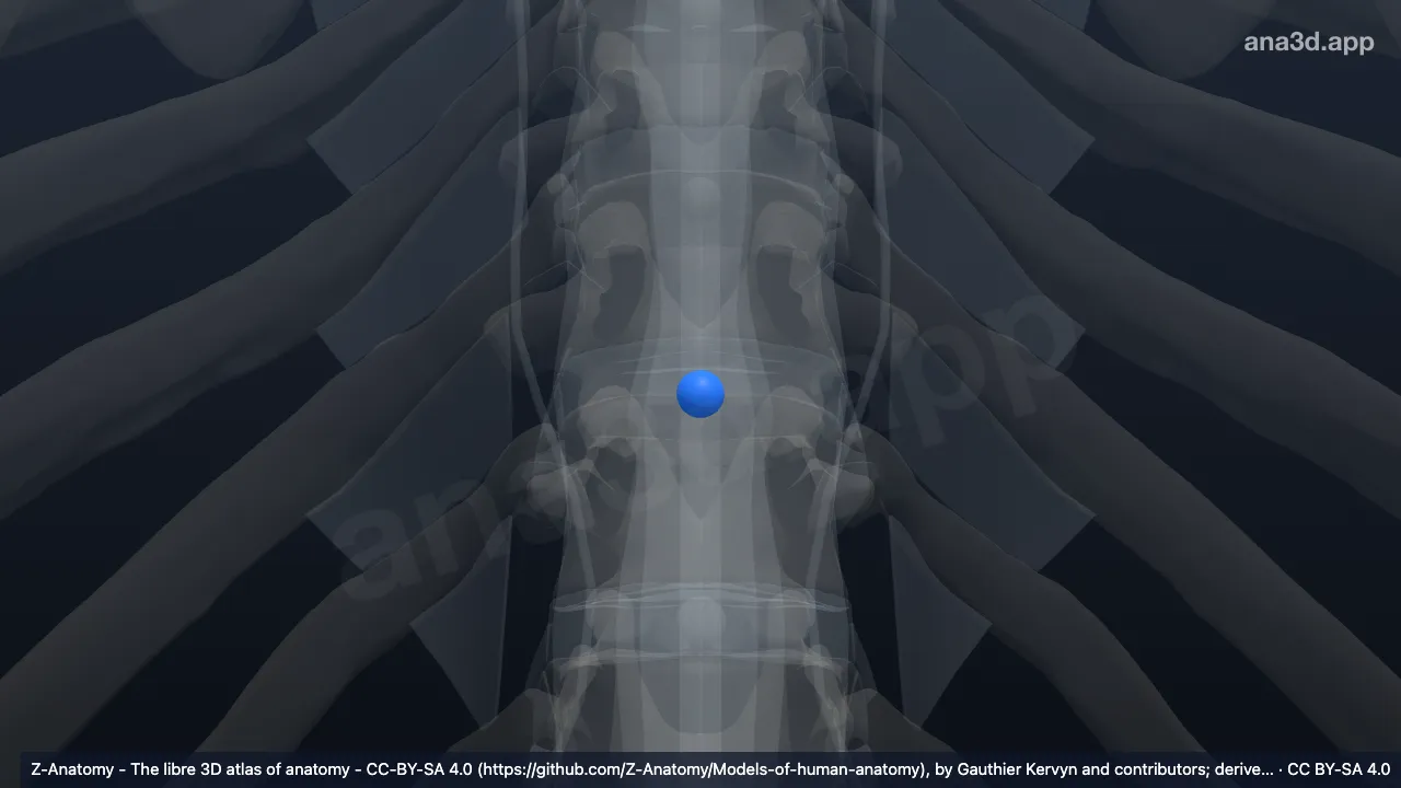 Modèle 3D : Noyau pulpeux T10-T11