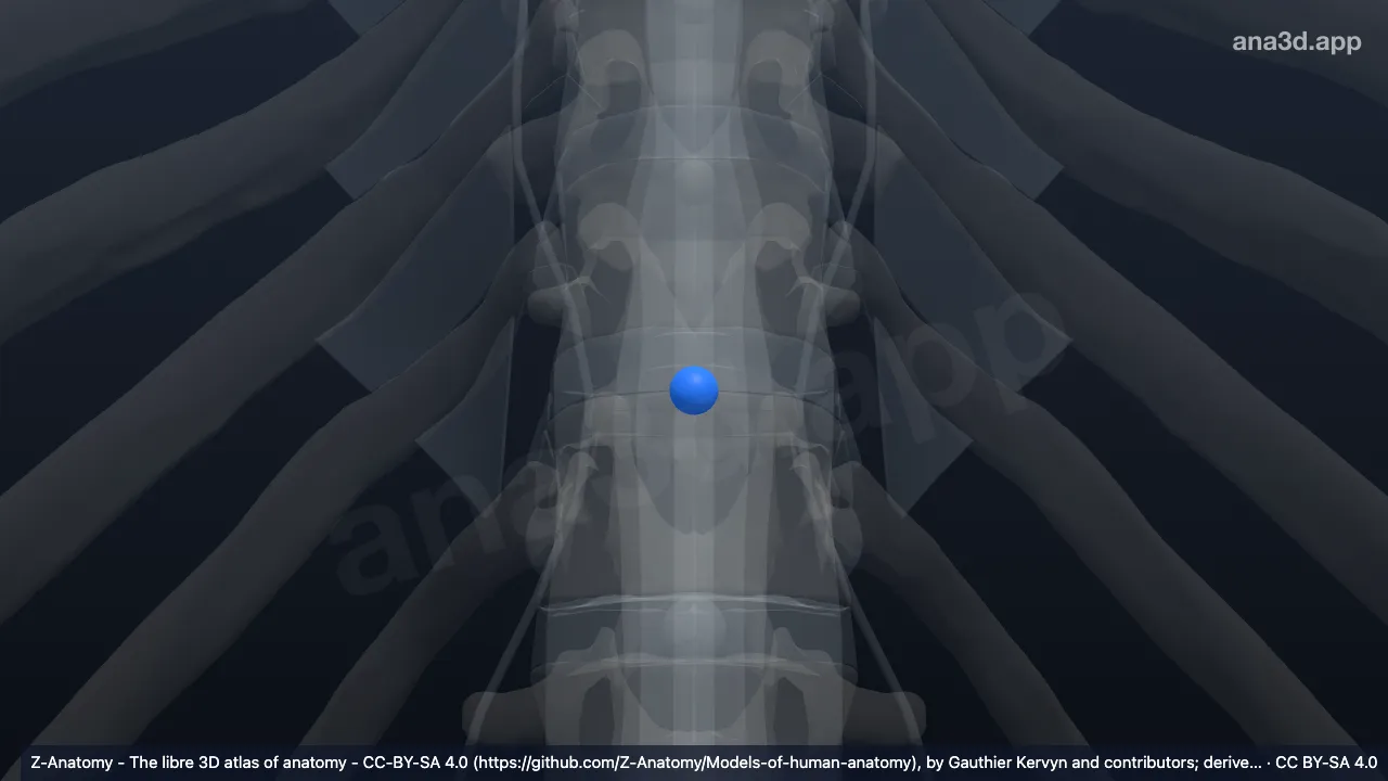 Modelo 3D: Núcleo pulposo T11-T12