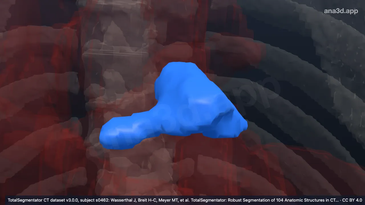 Model 3D: Apendiks atrium kiri