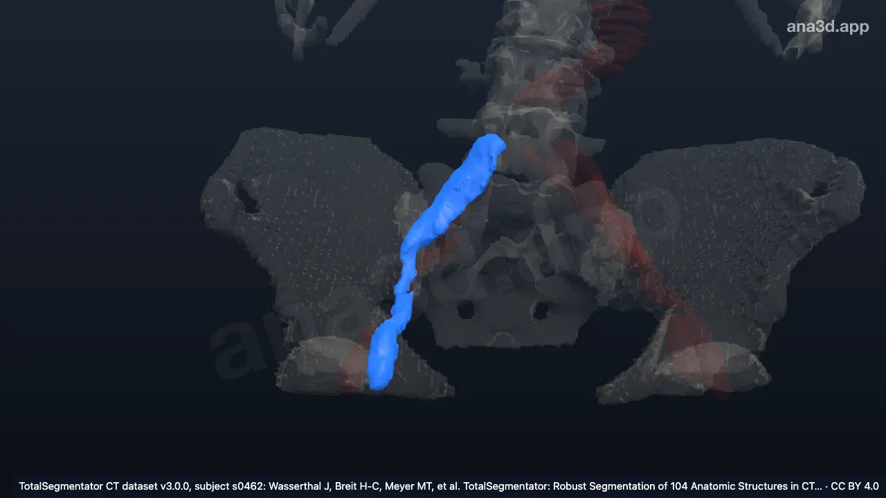Modelo 3D: Vena ilíaca derecha