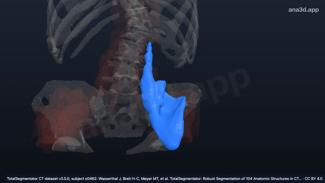 3D-Modell: Linker Musculus iliopsoas