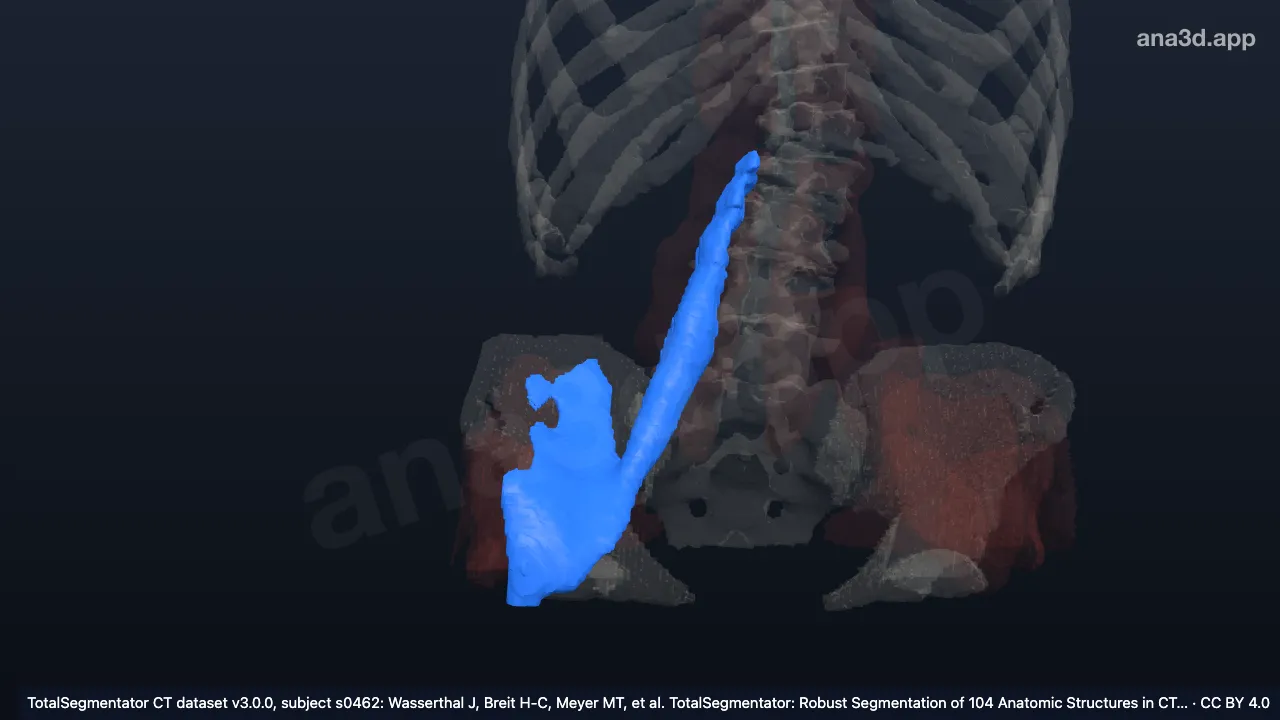 Modèle 3D : Muscle iliopsoas droit