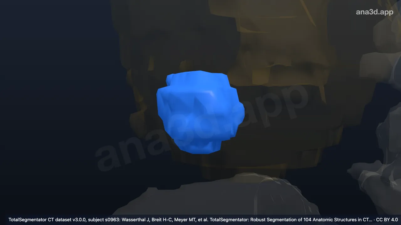 Modelo 3D: Quiste del riñón derecho