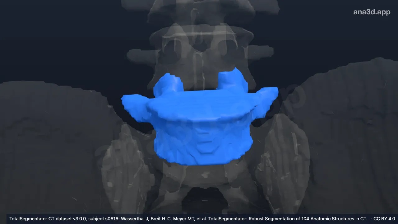 Modelo 3D: Sexta vértebra lumbar