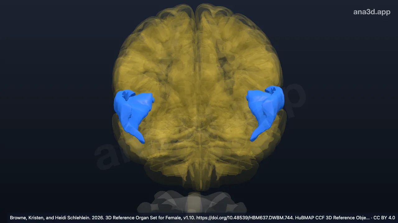 3D-Modell: Gyrus temporalis superior