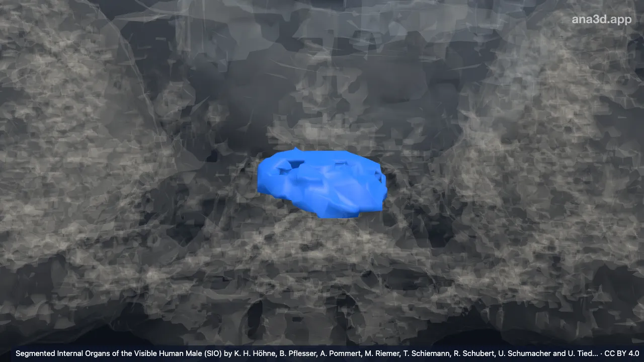 Model 3D: Diskus intervertebralis S1/S2