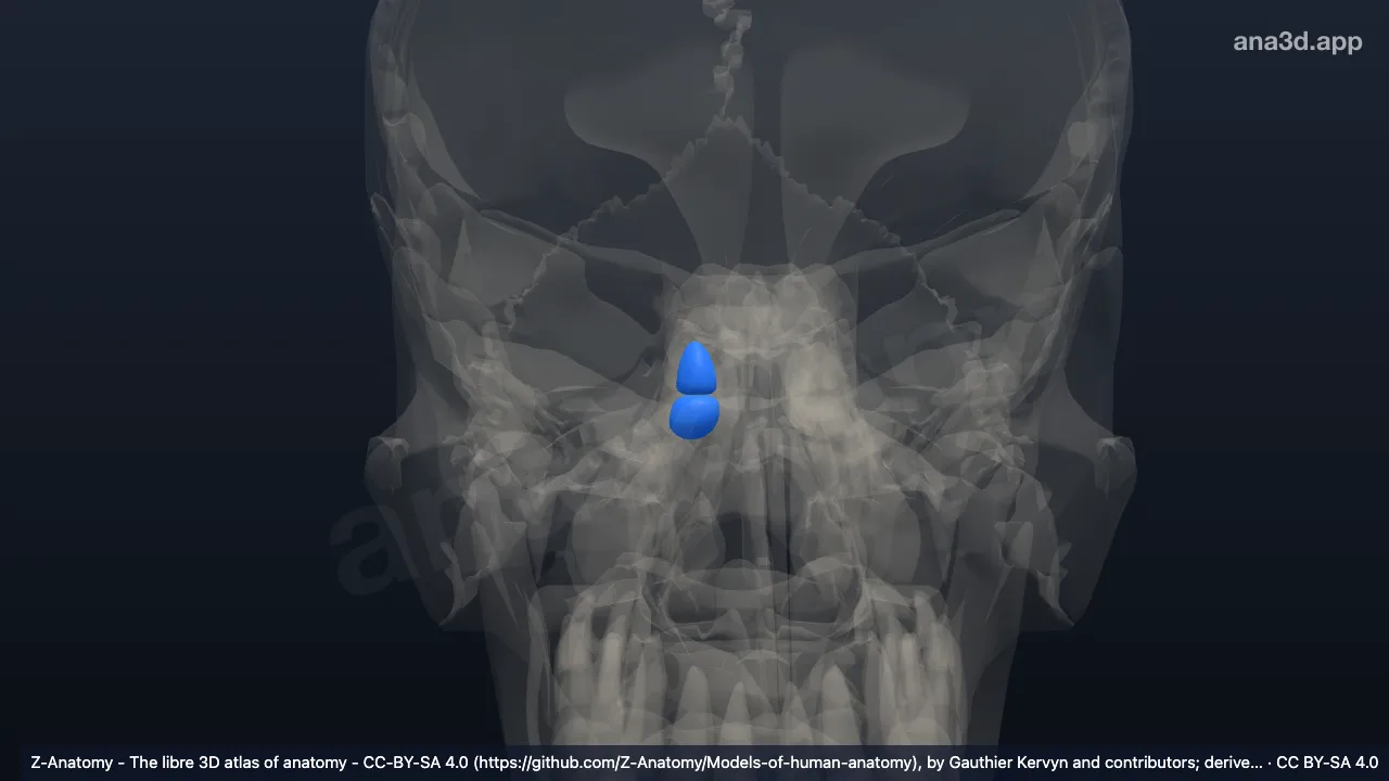 Model 3D: Sel anterior tulang etmoid kanan