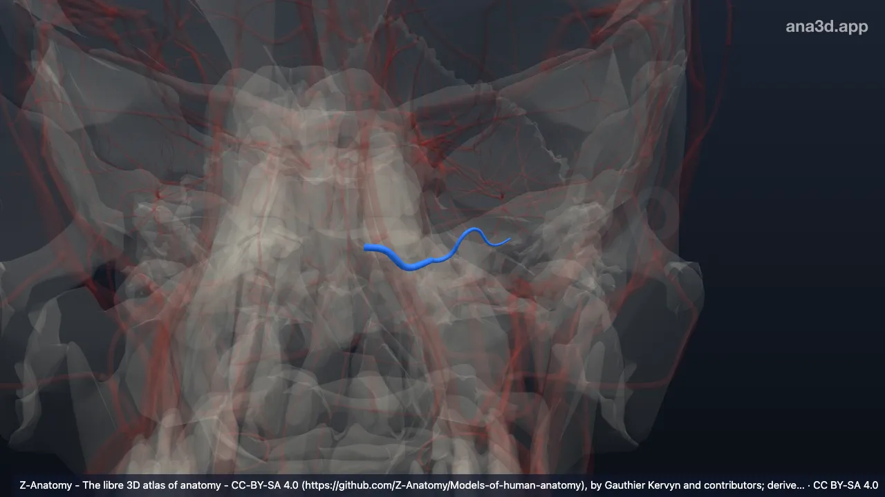 3D model: left anterior inferior cerebellar artery