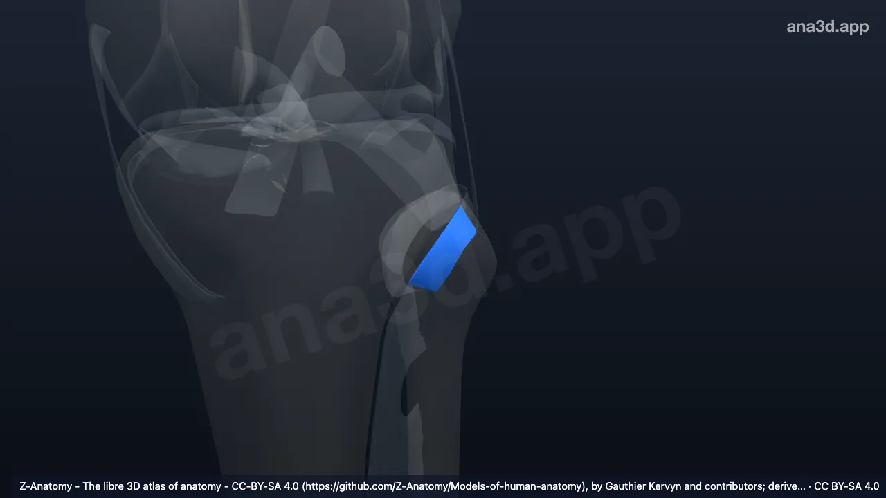 Mô hình 3D: Dây chằng chỏm xương mác trước trái