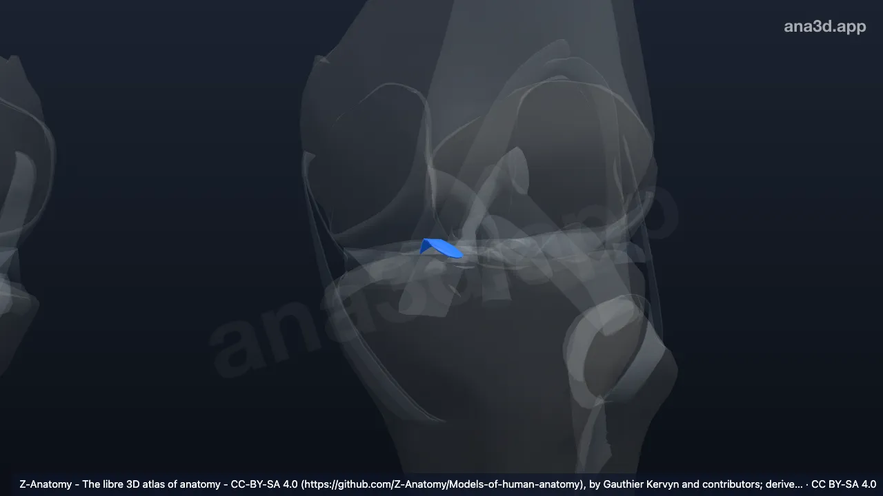 3Dモデル：左前半月脛骨靱帯(内側半月)