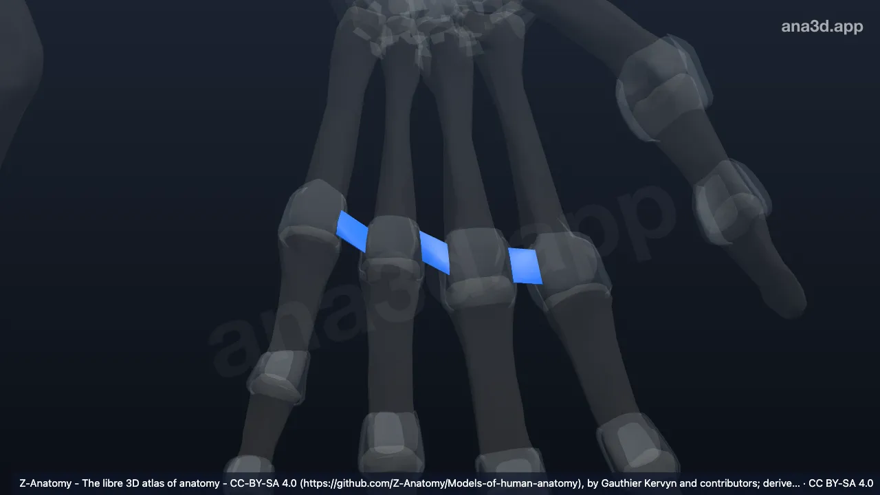 3D model: left deep transverse metacarpal ligament