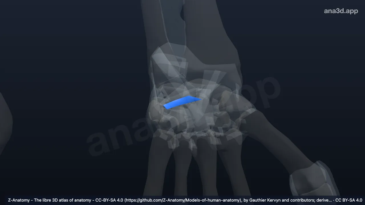 3D model: left dorsal scaphotriquetral ligament