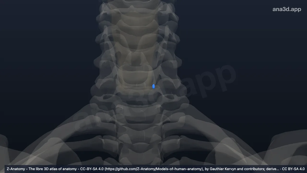 Modelo 3D: Glândula paratireoide inferior esquerda