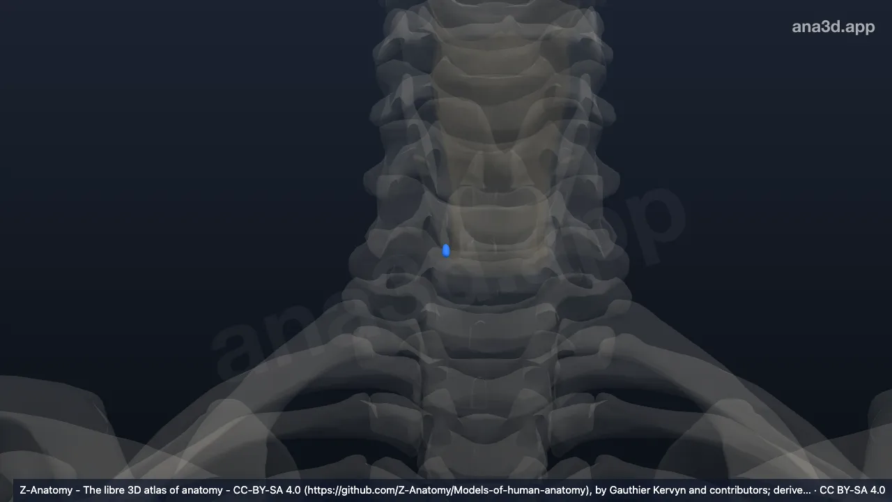 Modelo 3D: Glândula paratireoide inferior direita