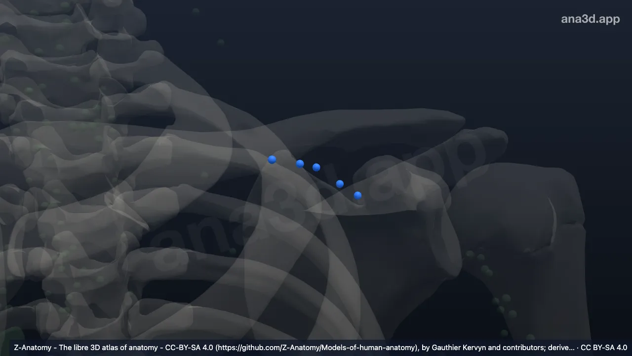3D model: left infraclavicular nodes