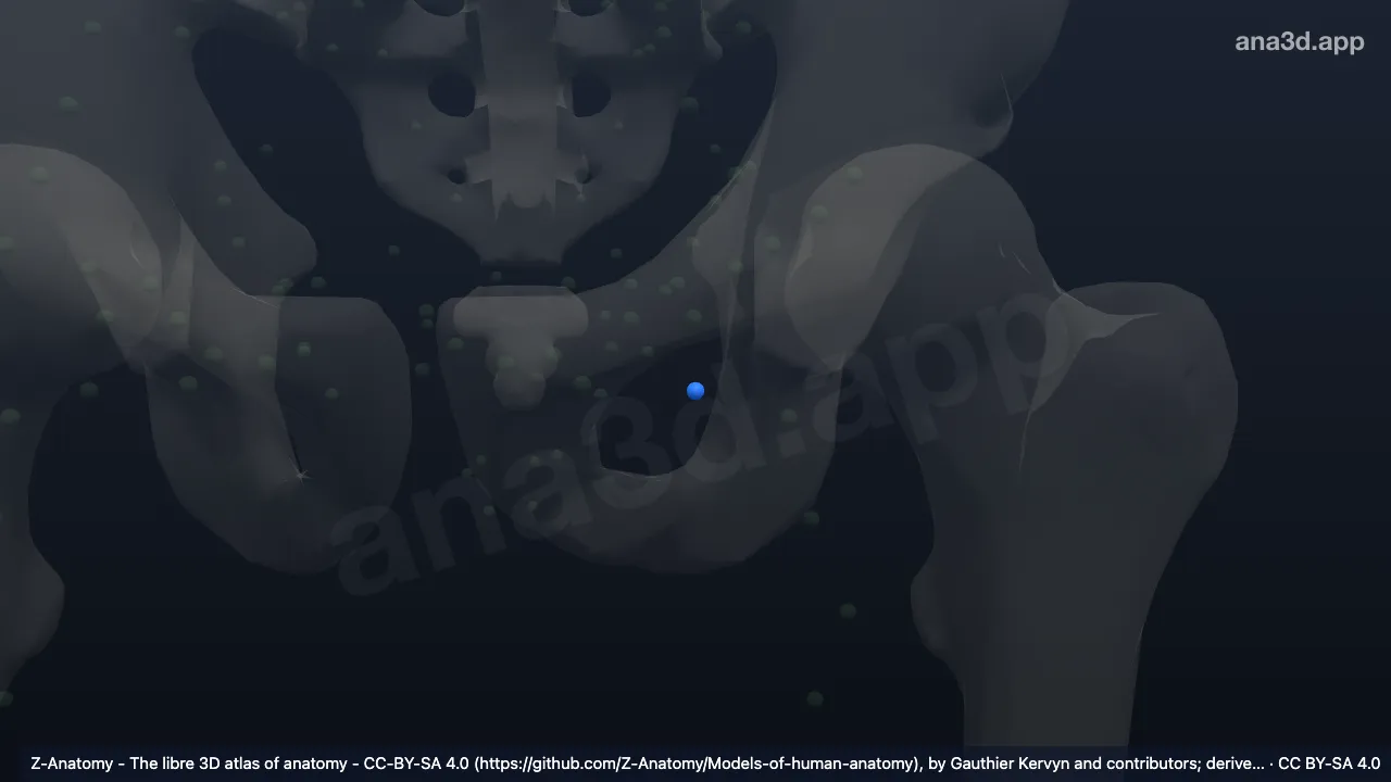 3D model: left (Intermediate deep inguinal node)