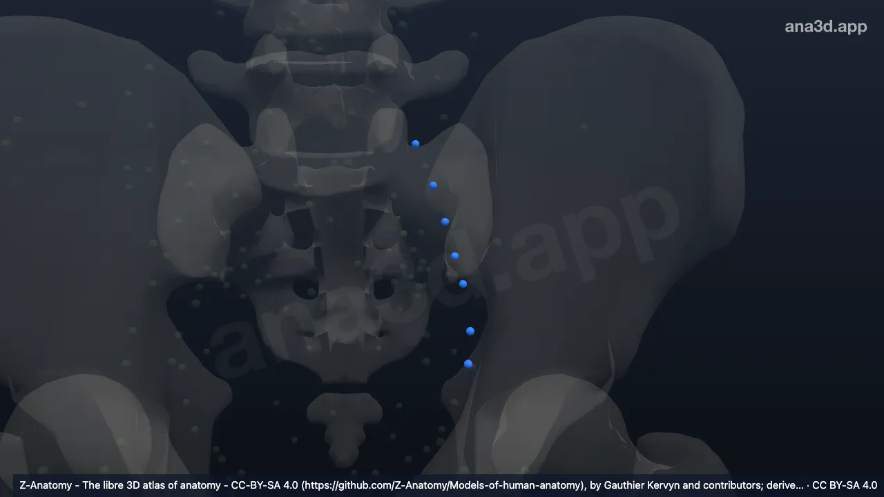 Modelo 3D: Linfonodos ilíacos externos intermediários esquerdos