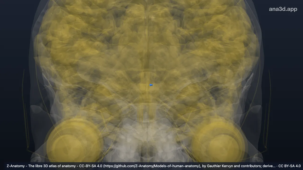 Modelo 3D: Fossa interpeduncular esquerda