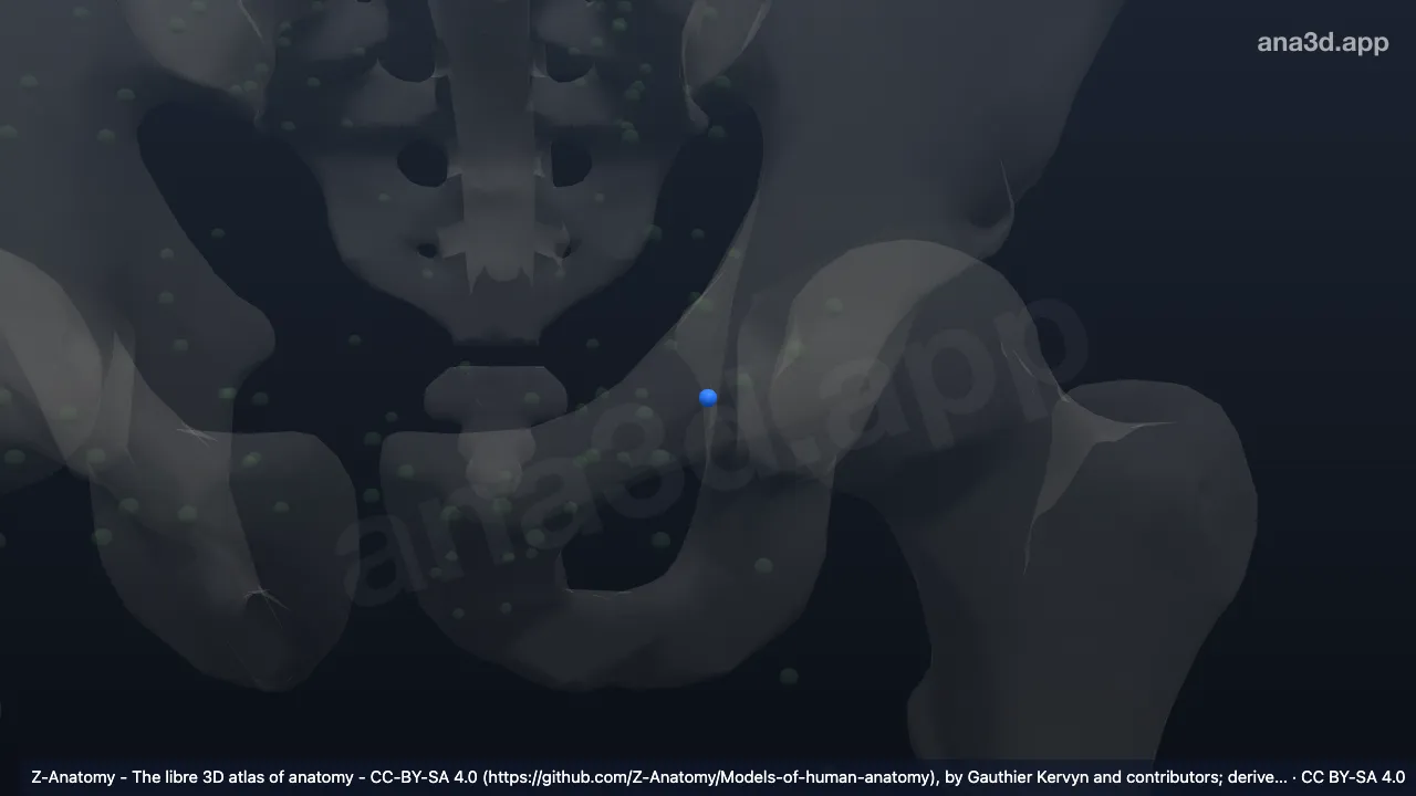 Modelo 3D: Linfonodo lacunar lateral esquerdo