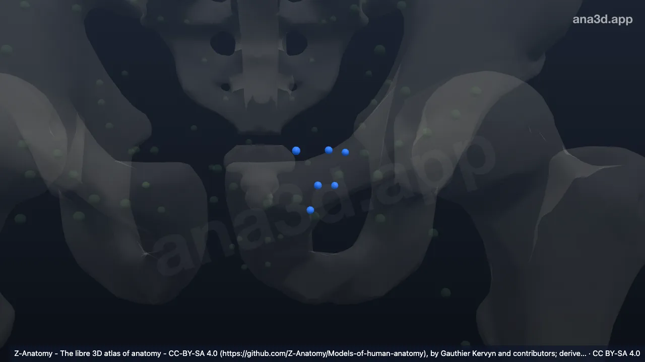 3D-Modell: Linke Nodi lymphoidei vesicales laterales