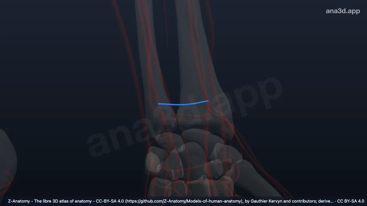 3D-Modell: Linker Ramus carpalis palmaris arteriae radialis