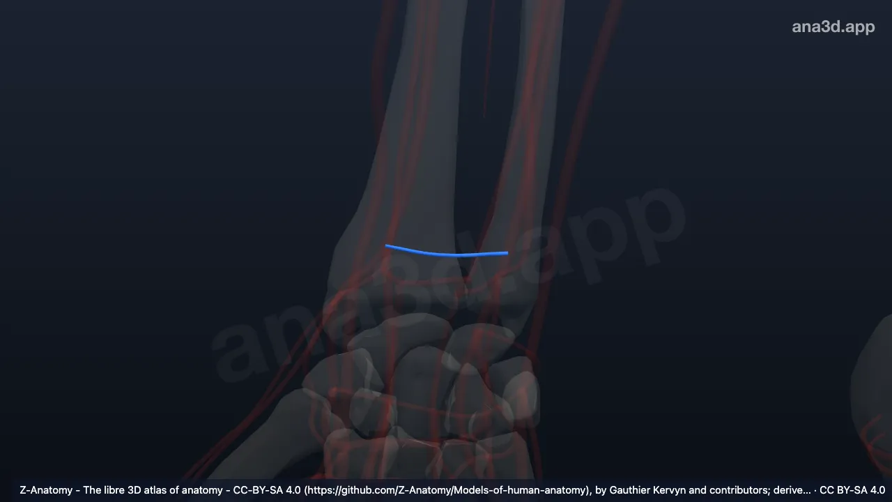3D 模型：右桡动脉腕掌支
