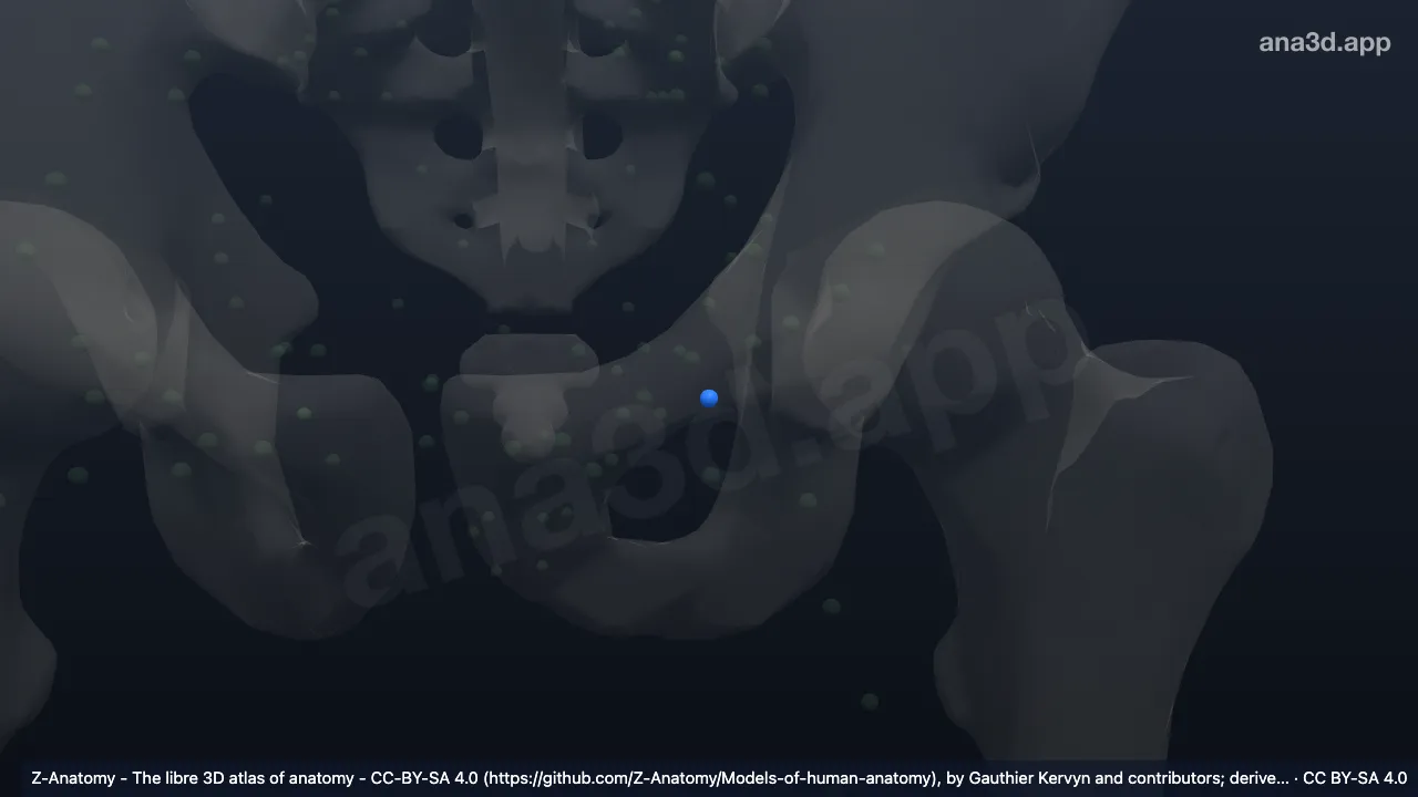 3D-Modell: Linker Nodus lymphoideus inguinalis profundus proximalis