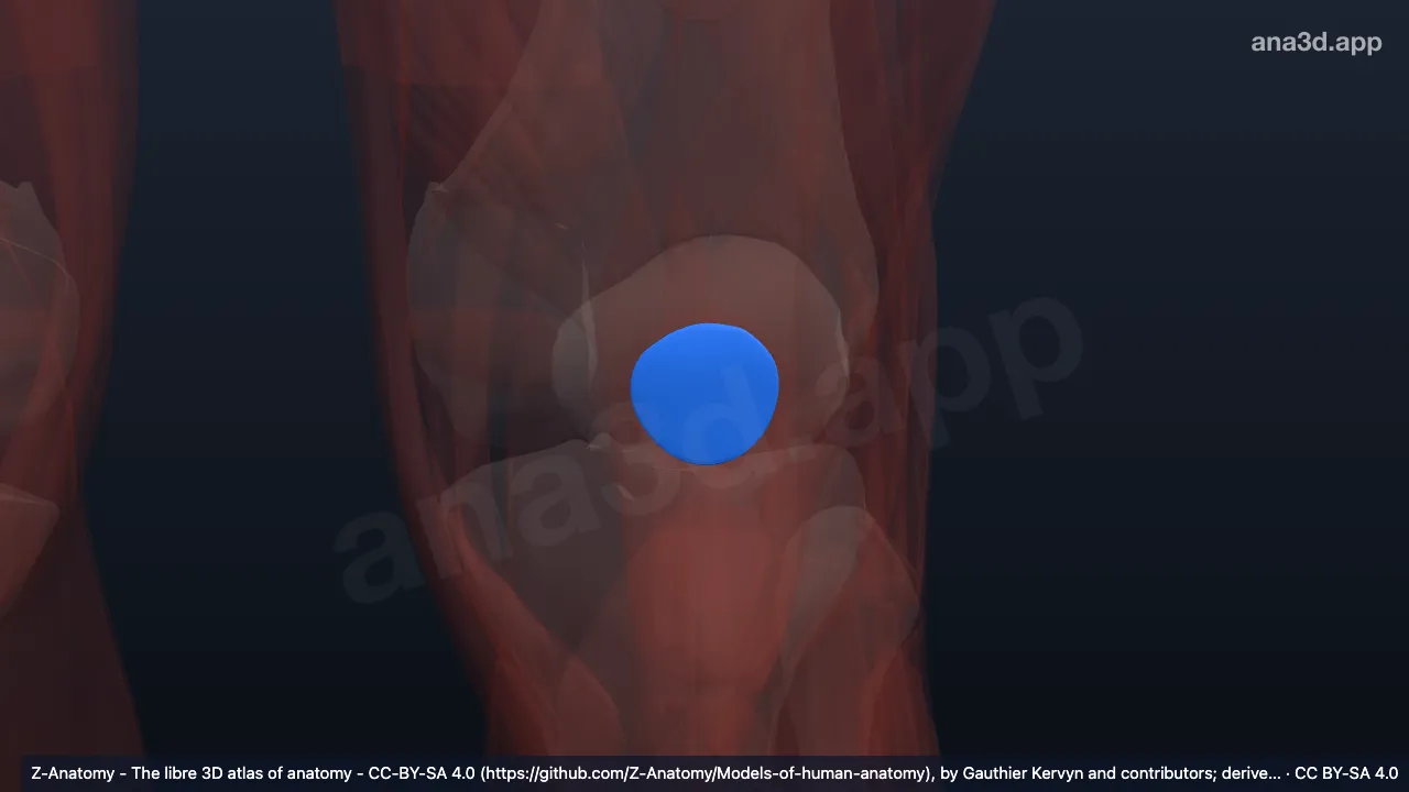 Modelo 3D: Bolsa prepatelar subfascial izquierda