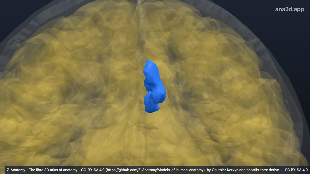 3D-Modell: Linker Sulcus subparietalis