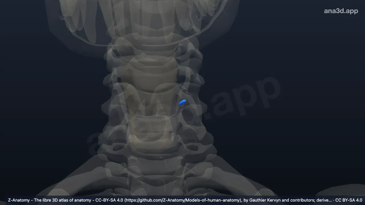Modelo 3D: Glándula paratiroidea superior izquierda
