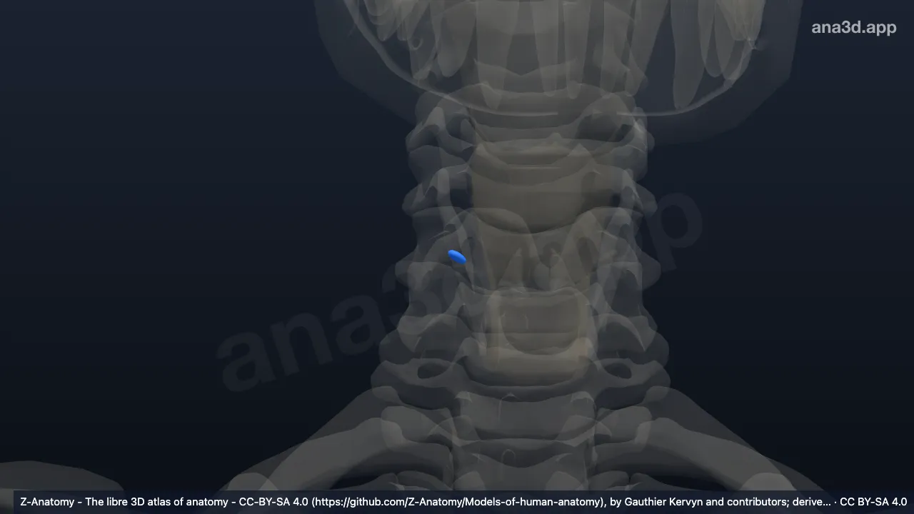 Modelo 3D: Glándula paratiroidea superior derecha