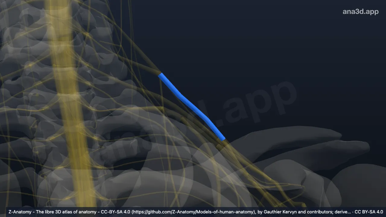 3D model: left superior trunk of brachial plexus