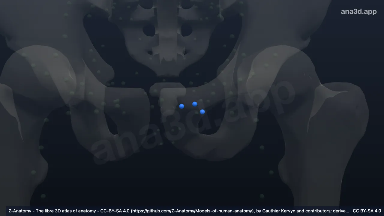 3D-Modell: Linke Nodi lymphoidei inguinales superficiales superomediales